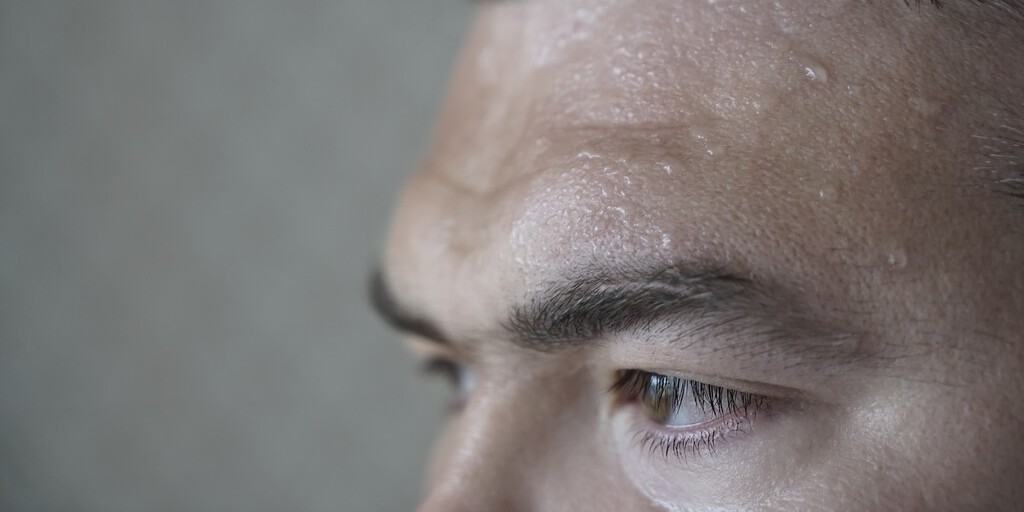 Nadmierne pocenie się głowy i twarzy