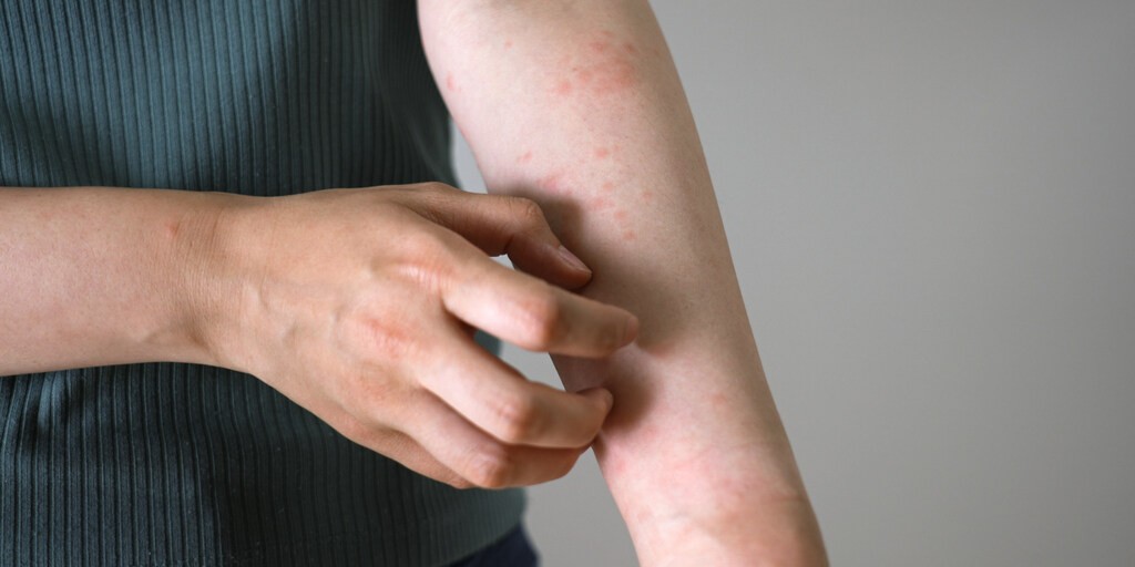 Alergia na proszek do prania